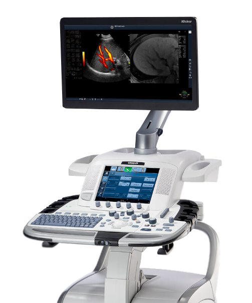 УЗИ премиум класса Logic E9 XDCLEAR 
с искусственным интеллектом УЗИ премиум класса Logic E9 XDCLEAR 
с искусственным интеллектом